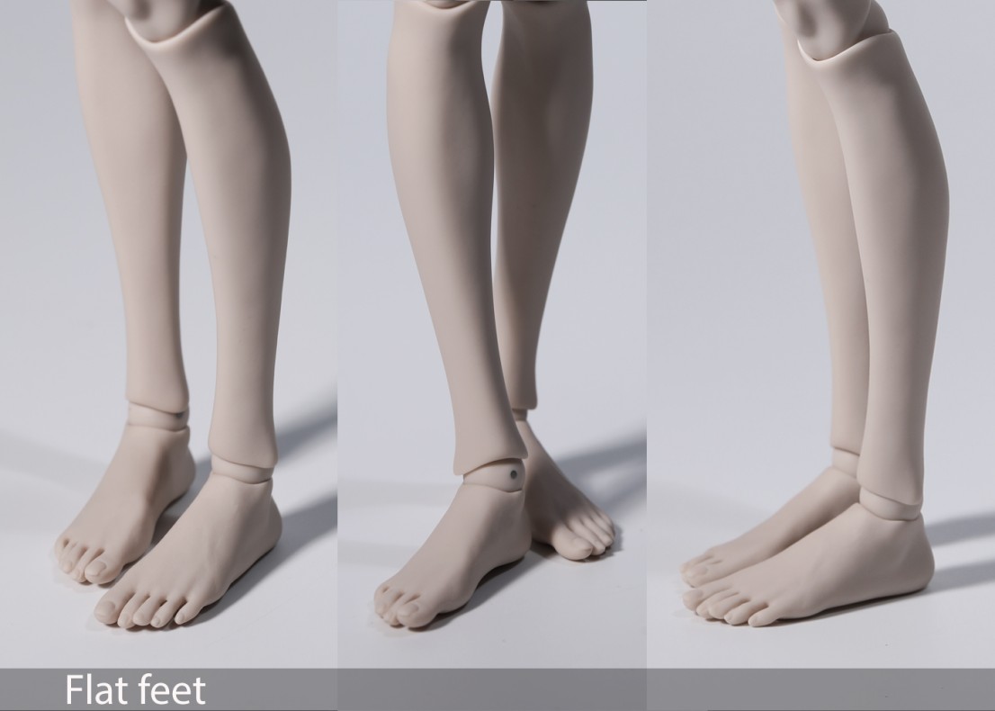 Плоская Стопа